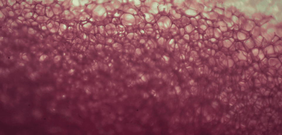 Mammogram-1200x630-2