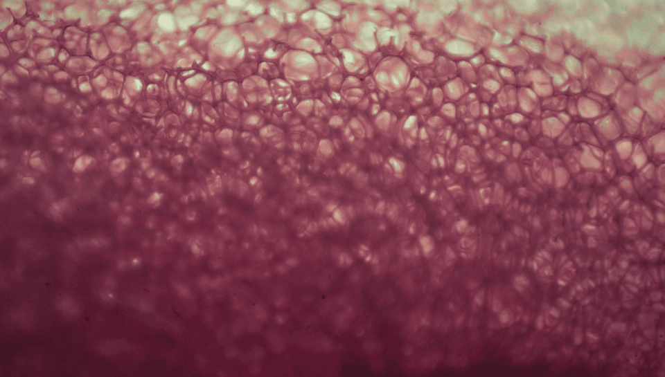 Mammogram-1200x630-2 Mammogram-1200x630-2